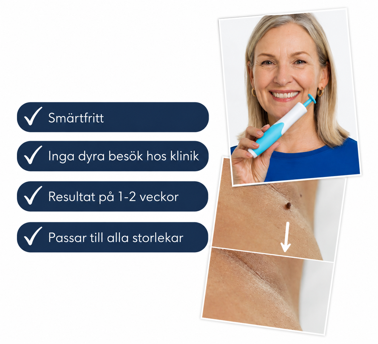 DermaTag™ | Bli av med hudflikar enkelt och hemma